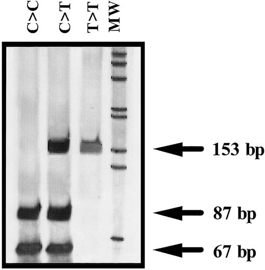 Fig. 1. Representative genotypes of the −1C>T polymorphism of the ANV gene. / MW indicates molecular weight marker (1-kb ladder) (GIBCO-BRL, Rockville, MD).