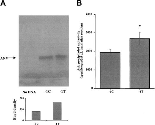 Fig. 2. Effect of the −1C>T polymorphism on the Kozak ANV sequence in an in vitro cell-free transcription/translation system. / (A) Representative autoradiogram of the SDS-PAGE analysis. A main band of 40 kDa is present both in −1C and in −1T plasmids, but not in the negative control. Densitometric analysis of ANV band shown in the gel (arbitrary units) indicates that more protein was synthesized from the −1T plasmid. (B) The 35S-methionine incorporated into acid-precipitable proteins in translation reactions containing −1C or −1T cDNA constructs of ANV. Results are mean (± SE) from 3 different series of experiments, each one including translation reactions with −1C or −1T cDNA or, as negative control, without cDNA. For each reaction, 6 replicates were analyzed, and the coefficient of variation between replicates was less than 30%. Precipitable radioactivity from negative control reaction without DNA was considered to be background and subtracted from corresponding values for −1C and −1T reactions. Significantly higher translation efficiency was associated with the −1T cDNA form (*P < .01).