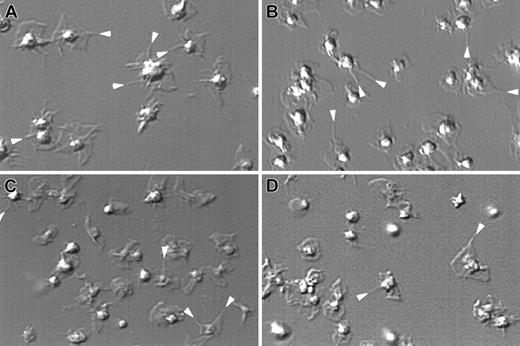 Fig. 1. Platelets change shape normally in the absence of WASp. / Platelets isolated from a healthy volunteer (A), WAS patient P39 (B), and wild-type (C) and WASp-deficient mice (D) were allowed to adhere on CRP-coated glass coverslips. Images shown are captured 10 minutes after the initial adhesion and activation reaction. Results shown are representative of the 3 patients studied. Filopodia are indicated by a white arrow.