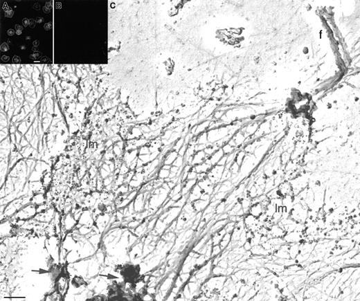 Fig. 5. Arp2/3 complex distribution in the cytoskeleton of active human platelets. / Human platelets were activated by centrifugation onto poly-l-lysine–coated glass coverslips, permeabilized with 0.5% Triton X-100 in PBS, and fixed and treated with 0.1% SDS. The actin cytoskeleton is labeled with a mixture of affinity-purified rabbit polyclonal anti-Arp3 and anti–p34-Arc antibodies and TRITC-labeled goat antirabbit IgG (A). Anti-Arp2/3 complex staining concentrated at the cell periphery and at foci in the center of the cytoskeletons. The peptides (50 μg/mL) used to raise the antibodies were used mixed with the anti-Arp2/3 complex antibodies as controls and blocked all detectable antibody binding (B). Human platelets were activated by centrifugation onto poly-l-lysine–coated glass coverslips, permeabilized with 0.75% Triton X-100 in PHEM buffer, fixed, and treated with 0.1% SDS (C). Cytoskeletons were labeled with a mixture of rabbit polyclonal anti-Arp3 and anti–p34-Arc antibodies followed by 10 nm colloidal gold coated with goat antirabbit IgG (black spheres). Cytoskeletons were fixed, washed into water, rapidly frozen, freeze-dried, and metal-coated. Immunogold recognizing Arp2/3 complex densely labels spread lamellar regions (lm) of the active cytoskeletons. Some internal structures are also labeled (arrows). The tips of the filopodia are poorly labeled (f). Note that the electron and light microscopy patterns are identical and that there are no filopodia labeled in panel A. Bars represent 5 μm (A) and 200 nm (C).