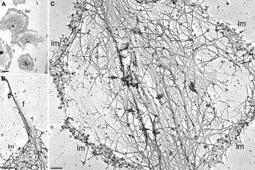 Fig. 6. Arp2/3 complex incorporation into the cytoskeleton of the active WAS platelet. / Platelets isolated from WAS patient P50 were activated by centrifugation onto poly-l-lysine–coated glass coverslips and permeabilized with 0.75% Triton X-100 in PHEM buffer. Cytoskeletons were labeled with a mixture of rabbit polyclonal anti-Arp3 and anti–p34-Arc antibodies and 10 nm colloidal gold coated with goat antirabbit IgG. Cytoskeletons were fixed, washed into water, rapidly frozen, freeze-dried, and metal- coated. Bars represent 2 μm (A) and 200 nm (B,C). Lm indicates lamellae; f, filopodia; arrows, foci of gold labeling.