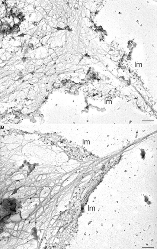 Fig. 7. Arp2/3 complex distribution in the active mouse platelet cytoskeleton. / Wild-type (A) and WASp-deficient (B) mouse platelets were activated by 1 U/mL thrombin on anti-GPIbα antibody-coated glass coverslips and permeabilized with 0.75% Triton X-100 in PHEM buffer. Cytoskeletons were labeled with a mixture of rabbit polyclonal anti-Arp3 and anti–p34-Arc antibodies and 10 nm colloidal gold coated with goat antirabbit IgG. Cytoskeletons were fixed, washed into water, rapidly frozen, freeze-dried, and metal-coated. Bars represent 200 nm; lm indicates lamellae; f, filopodia; arrows, foci of gold labeling.