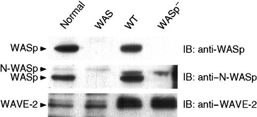 Fig. 9. Platelet WASp family proteins. / Lysates corresponding to 5 × 106 platelets isolated from a healthy volunteer (normal), WAS patient P34 (WAS), and wild-type (WT) and WASp-deficient (WASp−) mice were displayed by SDS-PAGE, transferred onto an Immobilon-P membrane, and probed with specific antibodies directed against WASp, N-WASp, and WAVE-2, as indicated. Results shown for the WAS platelets are representative of the 3 patients studied.