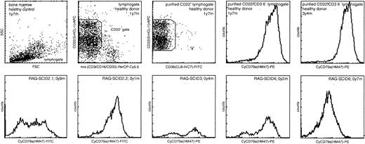 Fig. 1. BM samples of RAG-deficient SCID patients contained increased numbers of the most immature CD22+/CyCD79a− pro-B cells. / CyCD79a expression of the precursor B-cell compartment was analyzed within a lymphocyte gate and a CD22+ gate, which was “purified” by exclusion of cells with expression of CD3, CD16, or CD33. In healthy children the CD22+/CyCD79a−pro-B-cell subset represented a minor fraction of the total precursor B-cell compartment. In most RAG-deficient SCID patients this CyCD79a− subset was relatively large but variable in size. Furthermore, the level of CyCD79a expression in the SCID patients (mainly pre–B-I cells) was lower than in the healthy controls (mainly pre–B-II cells and immature B cells). The age at BM sampling is indicated.