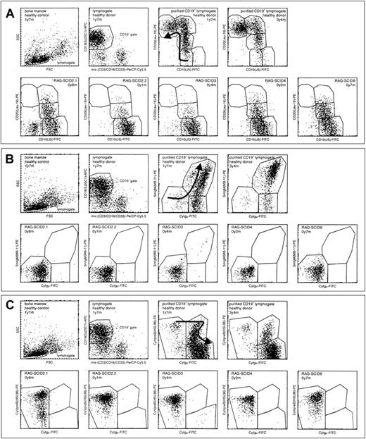 Fig. 2. Flow cytometric analysis of thawed BM samples from 5 RAG-deficient SCID patients compared to 2 healthy children. / The precursor B-cell compartment was analyzed within a lymphocyte gate and a CD19+ gate, which was purified by exclusion of cells expressing CD3, CD16, or CD33. (A) Analysis of CD10 and CD20 expression within the purified CD19+ lymphocyte gate. (B) Analysis of Cylgμ and SmlgM expression within the purified CD19+lymphocyte gate. (C) Analysis of Cylgμ and CyVpreB expression within the purified lymphocyte gate. The sequential order of the B-cell differentiation stages is indicated with arrows in the youngest healthy child. The composition of the precursor B-cell compartment in the 2 healthy children was representative of that in other healthy children (n = 6). In general, RAG-deficient SCID patients lacked the more mature B-cell differentiation stages with a strong relative increase in the immature B-cell differentiation stages. According to Nomura et al, expression of CyVpreB precedes expression of CD19.45Within a CD19+ lymphocyte gate, all cells should thus be CyVpreB+ or CyIgμ+ (C). Therefore, we suggest that the double-negative events represent apoptotic cells. The age at BM sampling is indicated.