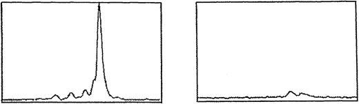 Fig. 4. Relative frequency. / Clone in patient Sy decreased from 15.6% to close to 0%.