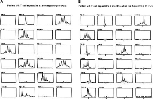 Fig. 5. Evolution of T-cell repertoire. / Patient Vd during PCE. The clonal population is defined by the usage of BV6B.