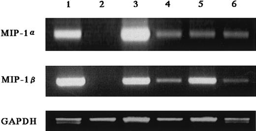 Fig. 3. Expression of MIP-1α and MIP-1β mRNA by MM cells. / Two micrograms of total RNA extracted from various myeloma cell lines was reverse transcribed, and 2 μL of the 20 μL reaction was used for PCR analysis of MIP-1α and MIP-1β, and GAPDH mRNA expression as described in “Materials and methods.” Cell lines used in these experiments were U266 (lane 1), RPMI8226 (lane 2), ARH77 (lane 3), IM-9 (lane 4), TSPC-1 (lane 5), and OPC (lane 6).