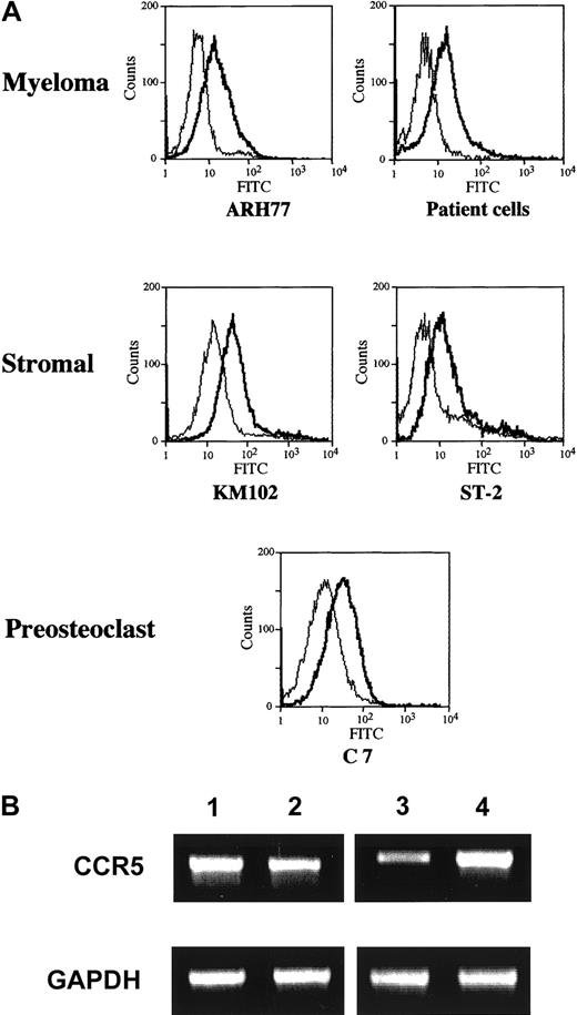 Fig. 6. CCR5 expression by MM cells. / (A) Surface expression of CCR5 on human MM cells and marrow stromal cells. A human MM cell line ARH77, primary MM cells from patients, and a marrow stromal cell line KM102, and a mouse stromal cell line ST-2 and a preosteoclastic cell line C7 were incubated first with mouse antihuman or mouse CCR5 antibodies or control IgG and then with an FITC-labeled secondary antibody, and were analyzed for the surface expression of CCR5 by flow cytometry as described in “Materials and methods.” (B) Expression of CCR5 mRNA. Expression of CCR5 mRNA as well as well an internal control GAPDH by ARH77 (lane 1), KM102 (lane 2), ST-2 (lane 3), and C7 (lane 4) was determined by RT-PCR analysis as described in “Materials and methods.”