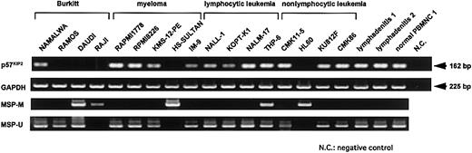 Fig. 2. RT-PCR analysis of p57KIP2 gene expression and MSP analysis of p57KIP2gene promoter region in various cell lines. / Upper arrow shows 162-bp RT-PCR product ofp57KIP2 gene; lower arrow, 225-bp RT-PCR product of GAPDH gene; U, PCR products amplified with primers specific for unmethylated DNA (MSP-U and MSP-A); M, PCR products amplified with primers specific for methylated DNA (MSP-M and MSP-A).