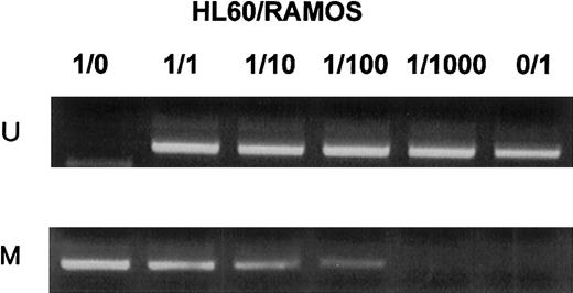 Fig. 5. MSP analysis of p57KIP2gene promoter region in mixtures of completely unmethylated and methylated cell lines. / Unmethylated (HL60) and methylated (RAMOS) cell lines were mixed at various ratios as indicated above each column. U shows PCR products amplified with primers specific for unmethylated DNA (MSP-U and MSP-A); M, PCR products amplified with primers specific for methylated DNA (MSP-M and MSP-A).