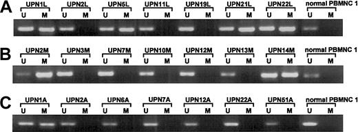 Fig. 7. Methylation analyses ofp57KIP2 gene in primary lymphoid malignancies detected by the MSP method. / U shows PCR products amplified with primers specific for unmethylated DNA (MSP-U and MSP-A); M, PCR products amplified with primers specific for methylated DNA (MSP-M and MSP-A); and UPN, unique patient number. (A) DLBCL and normal PBMNC 1. (B) MM and normal PBMNC 1. (C) ATL and normal PBMNC 1.