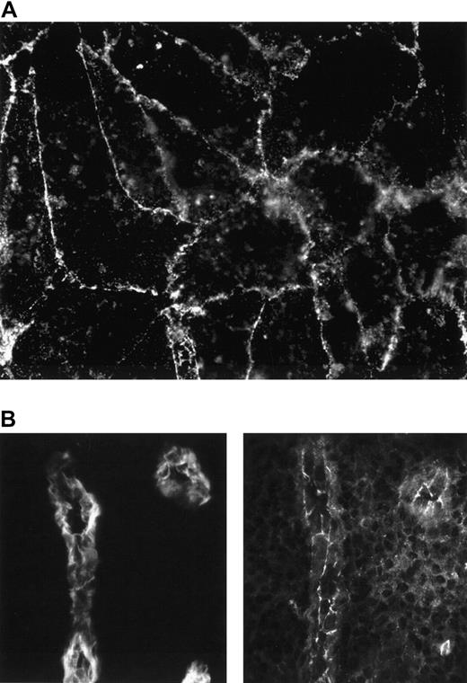 Fig. 6. JAM-2 is expressed on HUVECs in monolayers and on human tonsillar HEVs. / (A) Confluent HUVEC monolayers were stained with CRAM-19 H36 ascites and staining was revealed with antirat FITC. (B) Serial sections of human tonsil were stained with either MECA 79 antibody, recognizing carbohydrate epitopes of PNAd on lymphoid tissue HEVs (left panel) or CRAM-19 H 36 ascites, recognizing JAM-2 (right panel) and revealed with antirat FITC. Using the same settings for the CCD, no staining was detectable if primary antibody was omitted.