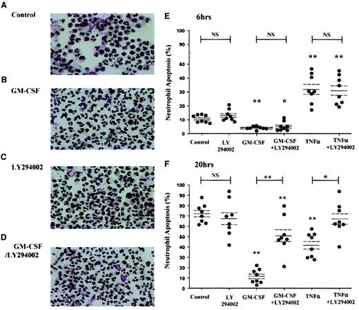 Fig. 2. GM-CSF and TNF-α promote neutrophil survival through a PI3-kinase–dependent mechanism, as assessed by cell morphology. / Peripheral blood neutrophils were cultured in the presence or absence of GM-CSF (10 ng/mL) or TNF-α (200 U/mL) with or without LY294002 (10 μM) for the time periods indicated. Cells were harvested at 6 and 20 hours, and cytospins were fixed and stained as detailed in the “Materials and methods” section. (A-D) Representative photomicrographs (original magnification, × 400) of neutrophils incubated with or without GM-CSF or LY294002 for 20 hours. (E-F) TNF-α caused an early (6-hour) increase and a late (20-hour) inhibition of neutrophil apoptosis, whereas GM-CSF caused a significant survival effect at both time points. LY294002 had no effect on the constitutive rate of neutrophil apoptosis or the early proapoptotic effect of TNF-α, but it inhibited the survival effect of GM-CSF and TNF-α at 20 hours. Data represent percentage apoptosis from 8 independent experiments, each performed in triplicate, together with mean ± SEM values. *P < .05 and **P < 0.005 compared with control values, unless otherwise indicated.