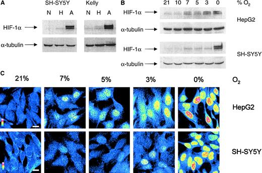 Fig. 2. Hypoxic HIF-1α protein accumulation and nuclear translocation in NB cells. / (A) Western blot analysis of HIF-1α was performed on whole-cell extracts from SH-SY5Y and Kelly cells cultured for 4 hours under normoxic (N), hypoxic (H), and anoxic (A) conditions. Antibody against α-tubulin was used to ensure equal loading. Gels are representative of at least 3 experiments. (B) To compare HIF-1α accumulation, HepG2 and SH-SY5Y cells were exposed to different O2 concentrations for 4 hours and whole-cell lysates (75 μg/lane) were subjected to Western blot analysis. (C) Indirect immunofluorescence analysis of HIF-1α in SH-SY5Y and HepG2 cells cultured for 4 hours under different O2 concentrations. Fluorescent intensities are shown in false colors, from blue (low fluorescence) to red (high fluorescence), as indicated by a colored scale bar; white scale bar represents 10 μm.