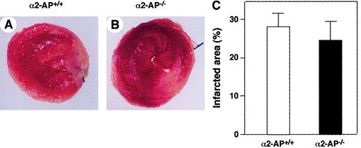 Fig. 1. Area of infarction in α2-AP+/+ and α2-AP−/− mice. / The areas of infarction are delineated by TTC staining of a representative heart after 12 hours of occlusion of the LAD coronary artery of α2-AP+/+ (A) and α2-AP−/− mice (B). Areas that appear pale white after TTC staining are infarcted. Each transverse section is cut 2 mm from the apex. Calculated infarct size is expressed as a ratio of infarct area to LV circumference. No differences were found between these 2 groups (C). Original magnification: × 8.