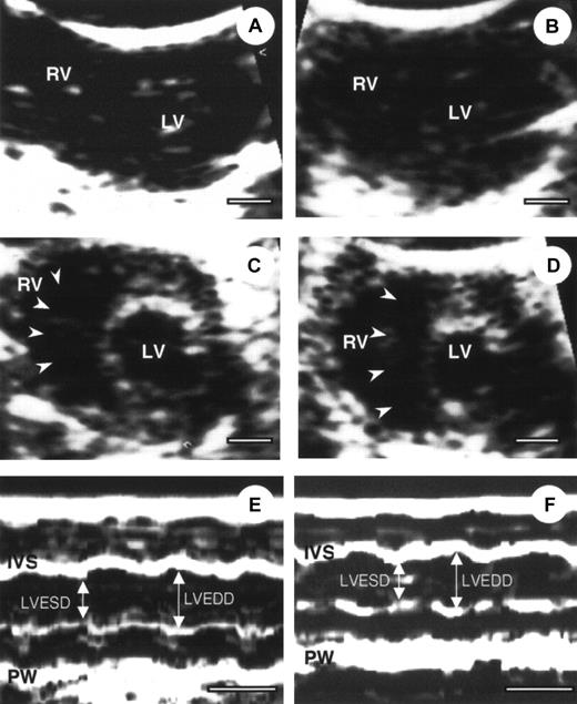 Fig. 2. Echocardiography of α2-AP+/+ and α2-AP−/−mice. / Representative example of 2-dimensional echocardiography (A-D) and M-mode echocardiograms (E,F) from α2-AP+/+ (A, before coronary ligation; B, after coronary ligation) and α2-AP−/− mice (C,E, before coronary ligation; D,F, after coronary ligation). M-mode echocardiograms showed the change of LVEDD after ligation in α2-AP−/− mice. White bar represents 1 mm (A-D) or 100 ms (E,F). Note, interventricular septum (arrowheads) deviated to left side after coronary ligation; IVS, interventricular septum; PW, posterior wall.