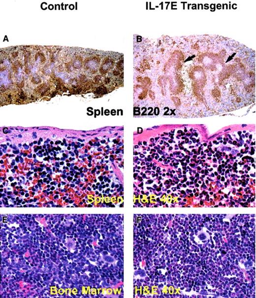 Fig. 4. Splenomegaly and bone marrow myeloid hyperplasia in the hIL-17E transgenic mice. / Transgenic spleen (B,D) and bone marrow (F) illustrate B220+ lymphoid hyperplasia (arrows) and marked eosinophilic myeloid hyperplasia, respectively, compared to the nontransgenic controls (A,C,E). The transgenic spleen also exhibited eosinophilic hyperplasia in the red pulp (D). Tissues are stained with hematoxylin and eosin (H&E) or B220 as indicated; magnification of × 2 or × 40 as indicated.