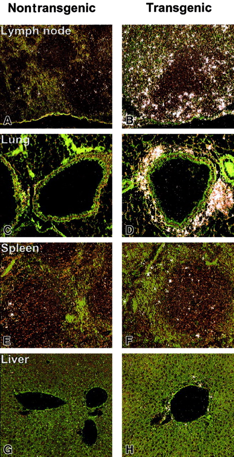 Fig. 8. In situ hybridization of IL-17Rh1 of IL-17E transgenic tissues. / Tissues from nontransgenic (A,C,E,G) and hIL-17E transgenic (B,D,F,H) mice. Lymph node, lung, spleen, and liver samples were hybridized in situ with a 33P-labeled anti–IL-17Rh1 riboprobe as described in “Materials and methods.” Highly increased IL-17Rh1expression in lymph nodes and areas of inflammation in the lung are indicated. Increased expression is also present in spleen and liver.