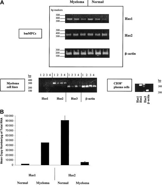 Fig. 1. HAS gene expression in healthy donor bmMPCs and myeloma cells. / RT-PCR products were amplified by competitive RT-PCR and resolved on a 1.5% agarose gel. Band intensity was determined by densitometry as indicated in “Materials and methods.” (A) Expression of Has mRNA in bmMPCs: RT-PCR for Has1, Has2, and β-actin in 3 healthy donors and 3 multiple myeloma patients and done as described in “Materials and methods” using primers indicated in Table 1. A representative result of 3 experiments is shown. Expression of HAS mRNA in myeloma plasma cell lines and ex vivo bone marrow plasma cells: (lane 1) ANBL-6, (lane 2) U266, (lane 3) ARH77, (lane 4) RPMI 8226. RT-PCR for Has1, Has2, Has3, and β-actin was done as described in “Materials and methods” and using primers indicated in Table 1. β-Actin was amplified to determine that all samples contained equivalent amounts of cDNA. (B) Competitive RT-PCR for Has1 and Has2 in 3 multiple myeloma patients and 3 healthy donors. One microgram of total RNA was reverse transcribed as indicated in “Materials and methods”; 2.0 μL cDNA was subjected to competitive PCR using primers for Has1 and Has2 as indicated in Table 1. RT-PCR was carried out in duplicate. The graph in panel B shows the results from duplicate quantifications of Has mRNA from 3 myeloma and 3 healthy donors.