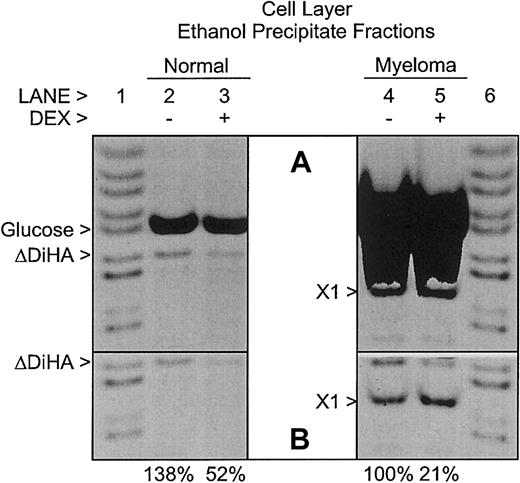 Fig. 4. Relative amounts of hyaluronan in cell layers from healthy donor and multiple myeloma patient–derived bmMPC cultures. / FACE analysis of HA in the cell layer ethanol precipitate fractions of bmMPC cultures derived from a healthy donor (lanes 2 and 3) and a myeloma patient (lanes 4 and 5). Cultures were incubated as indicated in the presence (+; lanes 3 and 5) or absence (−; lanes 2 and 4) of dexamethasone (DEX) as described in “Materials and methods.” All samples were digested with hyaluronidase SD, chondroitinase ABC, and glucoamylase as described in “Materials and methods.” No AMAC-derivatized bands were detected in the absence of enzyme digestion (data not shown), similar to the results shown in Figure 3. The gel image in panel A was overexposed to show minor bands, whereas the gel image in panel B was exposed such that all pixels were within the linear 12-bit depth range required for quantitation. In panel B, the AMAC-derivatized glucose bands in lanes 4 and 5 were covered to allow imaging of the AMAC-derivatized ΔDiHA bands. The percent HA detected as AMAC-derivatized ΔDiHA in each culture is listed below each lane in panel B and is normalized to the (−) DEX myeloma value. Note the presence of a prominent unknown band in the samples from the multiple myeloma patient (X1). AMAC-derivatized standards (lanes 1 and 6) include, from top to bottom,N-acetylgalactosamine, maltotetraose, maltotriose, maltose, glucose, ΔDiHA, ΔDi0S, 6-sulfatedN-acetylgalactosamine, and 4-sulfatedN-acetylgalactosamine. Each lane represents either 2.5% (healthy donor) or 5% (myeloma patients) of the total cell layer samples. Data presented are representative of 4 healthy donors and 4 myeloma patients. Similar results were observed in all donors.