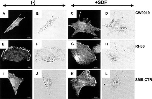 Fig. 6. Stress fiber formation in human RMS cells. / Upper panel, CW 9019 cells; middle panel, RH30 cells; and lower panel, SMS-CTR cells. Left half of the figure shows cells not exposed to SDF-1β; right half of the figure shows cells exposed to SDF-1β (300 ng/mL). Dark images are immunofluorescence pictures; light images are normal light pictures. Representative cells were selected.
