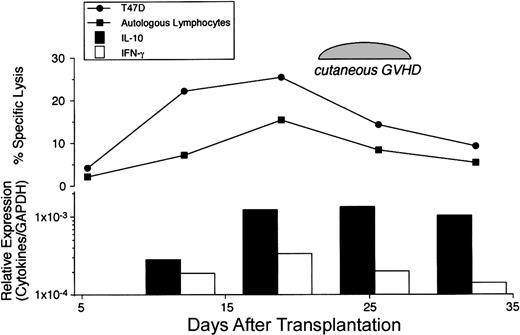 Fig. 3. Temporal relationship between cytolytic activity and cytokine expression. / The changes in the cytotolytic activity and cytokine mRNA expression over time were assessed in PBMCs from a patient who developed autologous GVHD following transplantation. Cytotoxicity against autologous PHA-blasts and the T47D breast cancer cell line was measured using a standard 51Cr release assay at a 100:1 effector-to-target ratio. Relative expression of IL-10 and IFN-γ mRNA levels normalized against GAPDH were determined by real-time PCR.