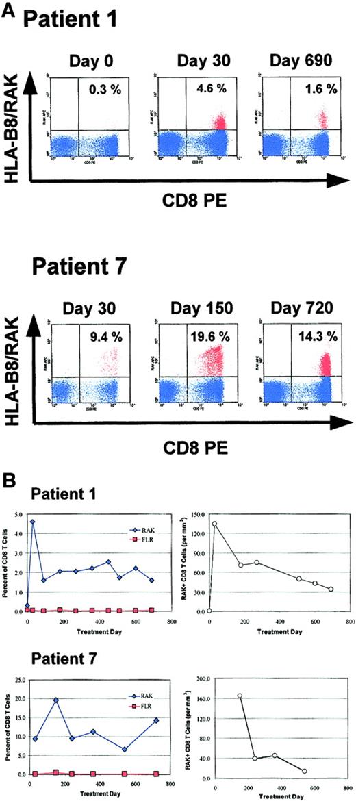 Fig. 5. Quantification of EBV-specific T cells in 2 HLA-B8+ patients with HLA tetramers. / Serial PBMC samples from 2 HLA-B8+ patients were analyzed by flow cytometry with APC-conjugated MHC/peptide tetramers. Representative results obtained at 3 time points with the HLA-B8 tetramer containing the RAKFKQLL peptide (HLA-B8/RAK) from the EBV immediate early gene BZLF-1 are shown in panel A. CD3+ events occurring in a lymphocyte gate are shown in blue. The percentage of CD8+ HLA-B8/RAK+ events is indicated in the upper right quadrant of each plot. (B) The serial analysis of RAK+ CD8+ cells in each patient, with RAK-specific CD8+ T cells represented as the percentage of CD8+ T cells (left) and as the absolute number (per microliter) in peripheral blood, calculated from the absolute CD8+ T-cell number determined by flow cytometry of fresh peripheral blood when available (right). Treatment day 0 is defined as the day when reduction of immunosuppression was initiated. Analysis with the additional tetramer reagent, HLA-B8/FLR (FLRGRAYGL; from the EBV latent gene EBNA-3A), is also shown.