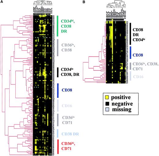 Fig. 2. Clustering analysis of patients with MDS and controls according the phenotype of CD45lo blast cells. / (A) Hierarchical clustering analysis of MDS patients. (B) Hierarchical clustering analysis of controls. Analysis was achieved with the 149 patients and 49 controls for whom at least 16 of the 20 markers of the panel had been tested, the number of events in the CD45lo/SS blast electronic gate was above 2000, and contamination of this gate with CD36+/CD11c−erythroblasts was below 20%. Color saturation was obtained for fluorescence ratios above 98 for the 2 clustering analyses.