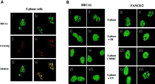 Fig. 4. Colocalization of activated FANCD2 and BRCA1 in discrete nuclear foci during S phase. / (A) HeLa cells were synchronized at G1/S with mimosine and released into S phase. S-phase cells were double-stained with the monoclonal anti-BRCA1 antibody D-9 (green; i,iv) and the rabbit polyclonal anti-FANCD2 antibody (red; ii,v), and stained cells were analyzed by immunofluorescence microscopy. Where green and red signals overlap, a yellow pattern is seen, indicating colocalization of BRCA1 and FANCD2 (iii,vi). (B) Differential effect of DNA damage on BRCA1 foci and FANCD2 foci during S phase. HeLa cells were synchronized with mimosine and released into S phase. Enriched S-phase–synchronized cell populations were analyzed by DNA flow histograms to ensure cell synchrony (data not shown). S-phase cells were untreated or were exposed to IR (5 Gy), MMC (20 ng/mL), or UV (50 J/m2) as indicated. One hour after treatment, cells were fixed and immunostained with antibodies to FANCD2 and BRCA1. Original magnification, × 600.