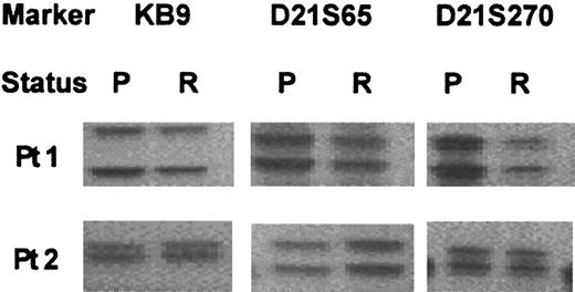 Fig. 1. Polymorphic marker analysis in 2 AML patients at presentation (P) and relapse (R). / Both patients presented with a FLT3/ITD, which was lost at relapse.