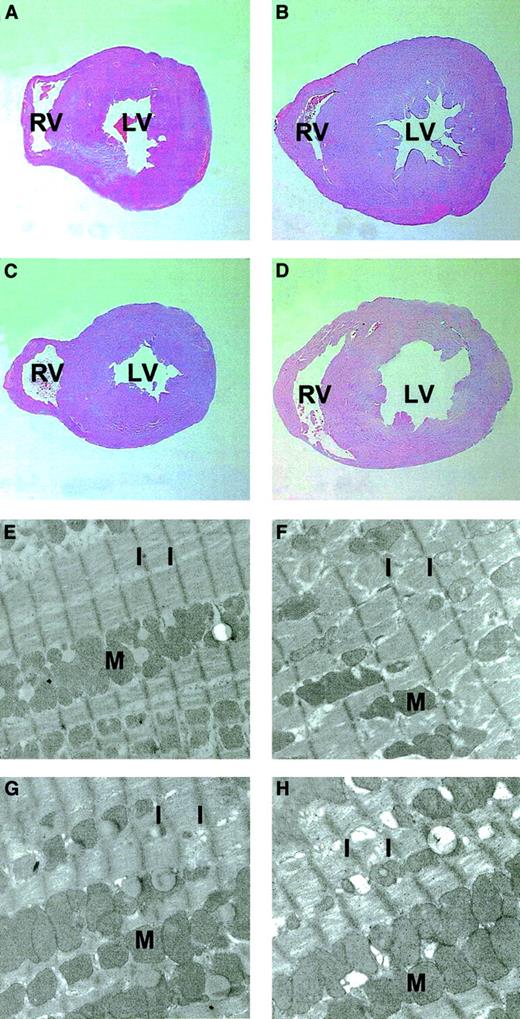 Fig. 5. Histologic and ultrastructural analyses of the cross-sections of hearts from AAV-CMVGFP– and AAV-HREEpo–treated Epo-TAgh and healthy mice. / (A-D) Histologic analyses. (E-H) Ultrastructural analyses. (A,E) Healthy heart. (B,F) Epo-TAgh heart showing enlargement/hypertrophy illustrated by the increased size of the heart and the increase in sarcomere length. (C,G) Healthy heart treated with AAV-HREEpo. (D,H) Epo-TAgh heart showing partial correction of the hypertrophy such that there is a decrease in the sarcomere length compared with the untreated Epo-TAghhearts. Note the reduction in the width of the left ventricle wall in panel D (AAV-HREEpo–treated Epo-TAgh mouse) compared with panel B (untreated mouse). LV indicates left ventricle; RV, right ventricle; M, mitochondria; I, I band of the striated cardiac muscle cell (the distance between these I bands is the sarcomere). Sarcomere length in anemic mice was 1.20 ± 0.20 μm, and in anemic mice treated with AAV-HREEpo it was 1.05 ± 0.08 μm (P = .0001), showing that the decrease in sarcomere length between these hearts was statistically significant. Original magnifications: × 12.5 for histologic analysis, × 2100 for ultrastructural analysis.
