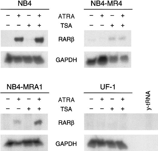 Fig. 6. HDAC inhibitor TSA potentiates ATRA induction ofRARβ mRNA expression in the ATRA-resistant NB4-MRA1 APL cells harboring the mutant I410T PML/RARα. / Ribonuclease protection analysis for RARβ expression of 50 μg total RNA isolated from ATRA-sensitive NB4 and ATRA-resistant NB4-MRA1, NB4-MR4, and UF-1 APL cells untreated or treated with 1 μM ATRA or 200 nM TSA and the combination of ATRA with TSA for 28 hours. The RNase-protected band corresponding to RARβ is identified, andGAPDH expression was used as a quantitative loading control. Yeast tRNA (y-tRNA) was included as a negative control to verify the specificity of the probes.