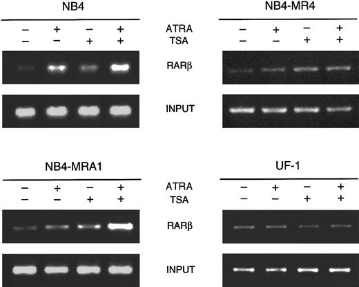 Fig. 7. HDAC inhibition by TSA intensifies ATRA-induced histone H4 hyperacetylation on chromatin of RARβ promoter in ATRA-resistant NB4-MRA1 APL cells. / Cross-linked chromatin preparations of ATRA-sensitive NB4 and ATRA-resistant NB4-MRA1, NB4-MR4, and UF-1 APL cells untreated or treated with 1 μM ATRA or 200 nM TSA, and the combination of ATRA with TSA were immunoprecipitated with an antibody against acetylated tails of histone H4. Immunoprecipitated and input material was analyzed by PCR using primers corresponding to the RARE region of theRARβ promoter.