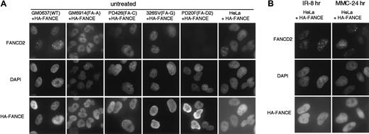 Fig. 2. Nuclear localization of HA-tagged FANCE protein. / The indicated SV40-transformed fibroblasts (GM0637, GM6914, PD426, 326SV, and PD20F) or HeLa cells stably transfected with HA-FANCE were double-immunostained with anti-FANCD2 and anti-HA antibodies. Counterstains for the DNA-specific dye DAPI are shown in the middle panels. (A) Untreated cells were stained. (B) Cells 8 hours after treatment with IR (15 Gy) or cells treated with MMC (40 ng/mL) continuously for 24 hours are shown. Original magnification, × 600.