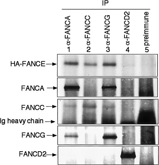 Fig. 3. HA-FANCE interacts with FANCA, FANCC, and FANCG in vivo. / Whole-cell extracts were generated from HeLa cells stably transfected with HA-FANCE. The same amount of protein from the extract (2 mg) was used for immunoprecipitation with affinity-purified anti-FANCA, anti-FANCC, anti-FANCG, anti-FANCD2 antibody, or preimmune serum, as indicated. Immune complexes were resolved by SDS-PAGE, transferred to nitrocellulose, and immunoblotted with anti-FANCA, anti-FANCC, anti-FANCG, anti-FANCD2, or anti-HA antibody.