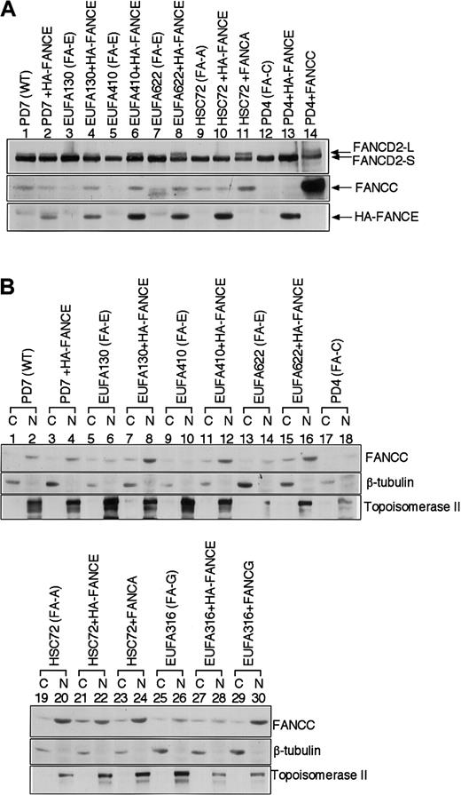 Fig. 4. FANCE is required for the nuclear accumulation of FANCC. / (A) Whole-cell extracts were prepared from the indicated lymphoblast cell lines. Cellular proteins were immunoblotted with anti-FANCD2, anti-FANCC, or anti-HA antibody. (B) Subcellular localization of FANCC in lymphoblast cell lines. Equal amounts of cytoplasmic (C) and nuclear (N) proteins from the indicated lymphoblast lines were immunoblotted with anti-FANCC, anti–β-tubulin, or anti–topoisomerase II antibody, as indicated.