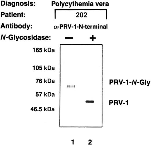 Fig. 4. PRV-1 is N-glycosylated. / Total cell extracts were prepared from granulocytes from patient EM. The extracts were either left untreated or subjected to digestion with 2.4 IU N-glycosidase at 37°C for 21 hours. Proteins were analyzed by Western blot using a polyclonal antibody generated against a PRV-1 peptide (amino acids 13-25 of the mature protein).