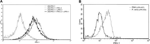 Fig. 5. PRV-1 is embedded in the cell membrane via a GPI anchor. / (A) 293 cells were stably transfected with an expression vector for PRV-1 and subjected to digestion with PIPL-C or left untreated. Cells were stained with a polyclonal antibody against PRV-1 followed by a FITC-conjugated secondary antibody (dark and light solid lines, respectively). As a control, both PIPL-C–treated and untreated cells were stained with the secondary antibody alone (dashed and stippled lines, respectively). FACS analysis was performed in a Becton Dickinson FACS Calibur equipped with a 488-nm laser. (B) Peripheral blood granulocytes were purified from a patient with polycythemia vera (dotted line) and one with PNH (solid line). Cells were stained with a polyclonal antibody against PRV-1 followed by a FITC-conjugated secondary antibody. FACS analysis was performed in a Becton Dickinson FACS Calibur equipped with a 488-nm laser.