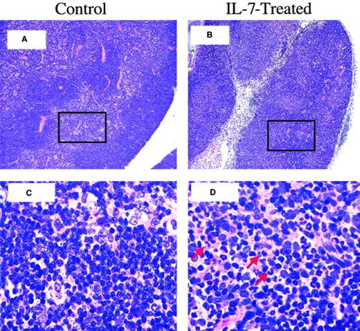 Fig. 4. Thymitis and cortical effacement in rhIL-7–treated BM transplant recipients. / Shown is thymic histology, day 21 after BMT, LN dose: 5 × 106 LN cells. (A) Thymic histology from a control BM transplant recipient, showing normal thymic cortex and medulla. (B) Thymus from an rhIL-7–treated BM transplant recipient with an atrophic thymus with cortical effacement. (C) Further magnification of boxed area in panel A, showing normal-appearing lymphocytes interspersed among epithelial cells of the medulla. (D) Further magnification of boxed area in panel B, showing evidence of inflammatory cells (red arrows) within the medulla. Original magnification is × 100 for panels A and B; ×1000 for C and D.