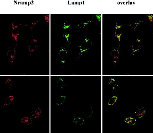Fig. 2. Subcellular localization of Nramp2/DMT1 and Lamp1 in Sertoli cells after phagocytosis of latex particles. / TM4 cells were fixed and stained with anti-Lamp1 followed by an FITC-conjugated secondary antibody (green) and anti-Nramp2/DMT1 with rhodamine conjugated secondary antibody (red), either before (upper panel) or 1 hour after phagocytosis of latex beads (lower panel). Cells were examined under a ×63 objective by confocal microscopy. Rhodamine (red, Nramp2/DMT1) and FITC (green, Lamp1) staining were overlaid (yellow shows overlap).