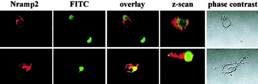 Fig. 5. Nramp2/DMT1 localizes around phagocytosed spermatozoids in TM4 cells. / Biotinylated spermatogenic cells were fed to TM4 cells before fixation and staining with FITC-avidin and anti-Nramp2/DMT1 antiserum and a rhodamine conjugated secondary antibody. Slides were analyzed by confocal microscopy, and images were overlaid. Phase-contrast images of the cells and a z-axis centered on the phagocytosed sperm are included.