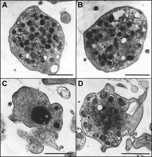 Fig. 8. Morphologic changes of platelets on stimulation in the presence and absence of α-synuclein in electron microscopy. / Purified platelets were prepared as described in “Materials and methods” and were fixed for TEM analysis. (A, B) Platelets in the resting state in the absence (A) and presence (B) of recombinant α-synuclein. (C) Platelets that have been stimulated with 0.5 μM ionomycin for 5 minutes before fixation. (D) Platelets that were preincubated with 10 μM recombinant α-synuclein before stimulation with 0.5 μM ionomycin. Scale bars, 1μm.