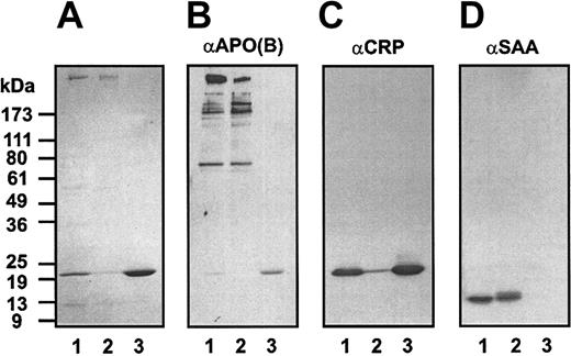 Fig. 4. Analysis of the isolated precipitate before and after anion exchange chromatography. / The starting material and materials recovered in peaks 1 and 2 (Figure3) were analyzed by nonreducing SDS-PAGE (A) and by immunoblotting for Apo B-100 (B), CRP (C), and SAA (D). Lanes 1 to 3 were loaded with the starting material, peak 1 material, and peak 2 material, respectively.