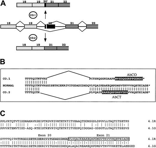 Fig. 1. Schematic representation of 4.1R, CO.1, CO.2, and 4.1G in their C-terminal regions. / (A) Abnormal splicing events generated at 4.1R pre-mRNA from exon 20 mutation, and leading to the spliceoforms encoding CO.1 and CO.2. (B) Amino acid sequence alignment of normal 4.1R, CO.1, and CO.2. Peptide epitopes for specific antibodies AbCO and AbCT are highlighted in black boxes. (C) Sequence alignment of 4.1R and 4.1G CTDs. Note the high degree of amino acid identity between the 2 proteins at 4.1R exons 20–encoded (shaded) and 21–encoded (boxed) sequence.