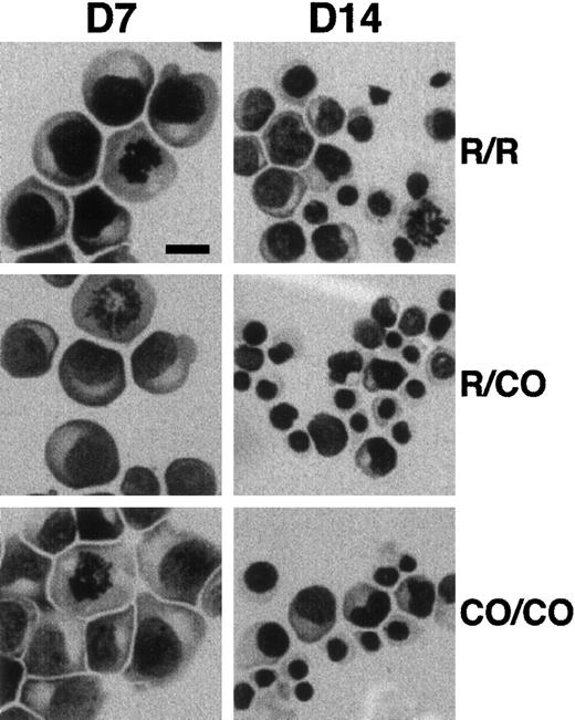 Fig. 2. Effect of 4.1R Coimbra mutation on cell morphology. / Erythroid cells from control (R/R), heterozygous (R/CO), and homozygous (CO/CO) persons after 7 (D7) and 14 (D14) days of culture. No obvious morphologic changes were noticed in CO cells in comparison with the control cells. Bar indicates 10 μm.