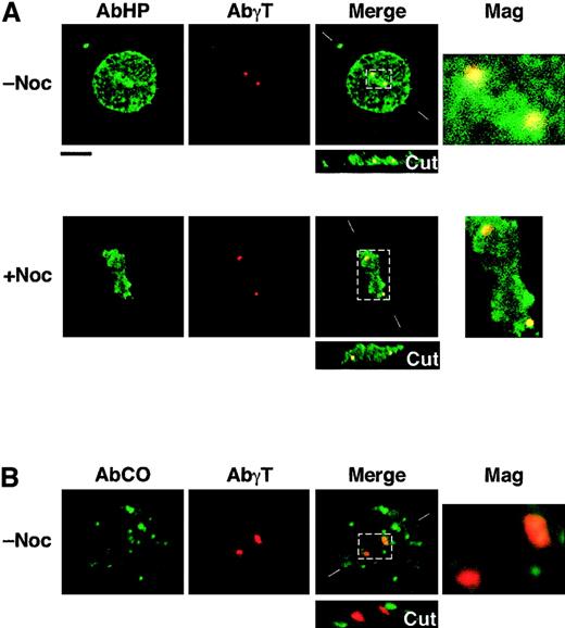 Fig. 4. Immunolocalization of shortened CO.1 and CO.2 isoforms at the centrosome. / Lymphoid control (not shown) and CO cells (panels A and B) were cultured in the absence (−Noc) or presence (+Noc) of nocodazole. (A) Double staining with AbHP and AbγT revealed the presence of 4.1R epitopes at the centrosome, in a microtubule-independent manner. Further staining with specific antibodies ascertained the absence of NuMA at the spindle poles in nocodazole-treated cells and the chromosome condensation between the centrosomes. (B) Staining with AbCO antibody showed a punctate distribution of CO.1 isoform throughout the cell, but failed to show a specific localization at the centrosome, in both microtubule-stabilizing and microtubule-destabilizing (not shown) conditions. Bar indicates 10 μm.