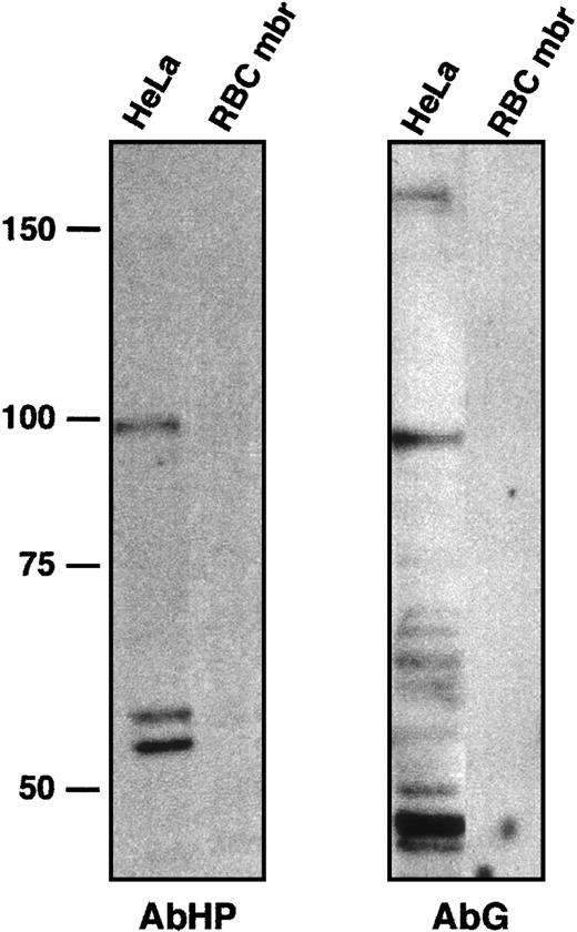 Fig. 5. Characterization of anti-4.1G antibody AbG. / To test a possible cross-hybridization between AbHP and AbG, HeLa whole-cell extract and red blood cell membrane (RBC mbr) samples were immunoblotted with AbHP (left panel). The blot was then stripped and probed with AbG (right panel). Red blood cell membrane proteins served as negative control for both antibodies. AbHP revealed bands around 98 and 54 to 59 kDa, comparable in size to 4.1R isoforms found in nuclear matrix.7 AbG revealed a high-molecular–weight isoform of approximately 160 kDa, similar to a full-length 4.1G isoform observed in transfected cells,5 or an endogenous 4.1G isoform found in PC12 cells.26 Other smaller and uncharacterized bands reacted with AbG, but not with AbHP. The band approximately 96 kDa in particular is slightly smaller than the 98-kDa isoform reacting with AbHP.