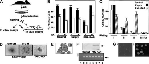 Fig. 1. PML-RAR expression causes RA-sensitive differentiation block and enhanced survival in vitro. / (A) Scheme of the experimental strategy. (B) Uninfected (Control) or sorted cells infected with the empty vector (Empty), or PML-RAR–expressing cells were plated in methylcellulose medium containing IL-3, IL-6, SCF, G-CSF, and GM-CSF, in the presence or in the absence of RA (1 μM). Colonies were pooled and analyzed for the presence of the myeloid differentiation markers MAC1 (▪) and GR1 (■). (C) Control, empty, or PML-RAR cells were plated as described. Colonies were pooled and 10 000 cells were reseeded in methylcellulose plates. This procedure was repeated twice, and in the third plating RA was also included in the medium. (D) Typical morphology of the colonies observed in control (× 50), or PML-RAR expressing cells (× 100). The “clusters” of PML-RAR–expressing cells are particularly evident from the second plating. Control colonies derive from cells infected with the empty vector. Identical results were obtained from uninfected cells. (E) Wright-Giemsa staining of PML-RAR pooled colonies (third plating), after cytospins. (Fi) Western blot analysis using an anti-RAR antibody of sorted cells from control and PML-RAR infections. The arrow indicates the PML-RAR protein. (Fii) DNA-PCR analysis of several individual colonies (lanes 3-8) obtained from growing PML-RAR expressing cells in semisolid medium. Lane 1: negative control, from one control colony; lane 2: positive control, from plasmid DNA. The arrow indicates the specific, amplified PCR product. (Gi) PML expression pattern in lin− cells by immunofluorescence using anti-mPML antibodies (× 125). (Gii) PML-RAR expression pattern on pooled colonies by immunofluorescence using anti-hPML antibodies (× 125). Double immunofluorescence with anti-mPML antibodies showed delocalization of the normal PML signal from “nuclear bodies” to microspeckles colocalizing with hPML-RAR (data not shown).