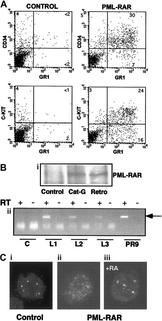 Fig. 4. Characteristics of APL blasts. / (A) Mice showing overt signs of disease were killed, and spleen cells were analyzed for expression of several surface markers. Spleen cells from untreated mice are shown for comparison in the left panels. PML-RAR blasts are CD34+/C-KIT+/MAC1+/GR1+. (B,C) In panel B, expression of PML-RAR in APL blasts was confirmed (Bi) by analysis of PML-RAR expression by immunoprecipitation with an anti-PML antibody, followed by Western blot using anti-RAR antibodies. Spleen cell extracts were prepared from control and leukemic animals obtained as outlined in Figure 1, or leukemic animals derived from cathepsin G-PML-RAR transgenic mice.8 Panel Bii shows RT-PCR analysis of RNA obtained from the bone marrow of 3 independently derived leukemic mice (L1-L3). Reverse transcriptase was omitted in the samples marked with the minus sign as control. Negative control (lanes “C”) is from a control mouse, positive control (lanes “PR9”) derives from U937 cells stably transfected with PML-RAR; the arrow indicates the specific, amplified PCR product. (C) Immunofluorescence of bone marrow cells from a leukemic mouse prior to (Cii), or after 5 days of RA treatment (Ciii), using antibodies against mouse PML (original magnification × 630). Control, normal bone marrow cells (Ci).